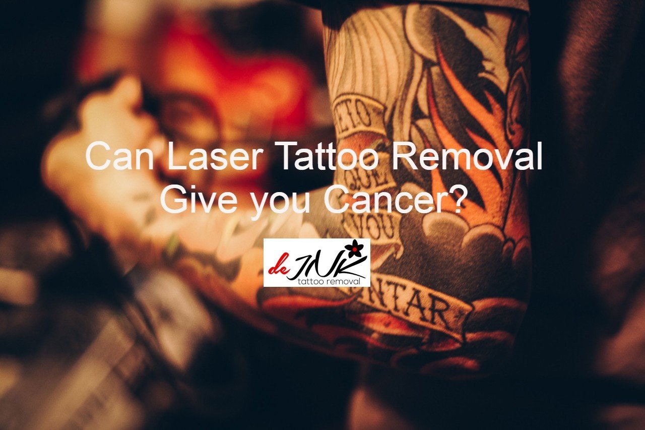 Share more than 65 laser tattoo removal cancer risk super hot vova.edu.vn