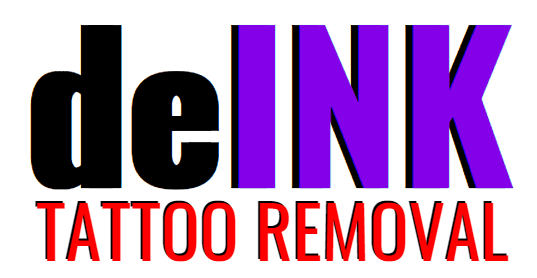 Top Rated Laser Tattoo Removal Services In Auckland, NZ| deINK Tattoo  Removal