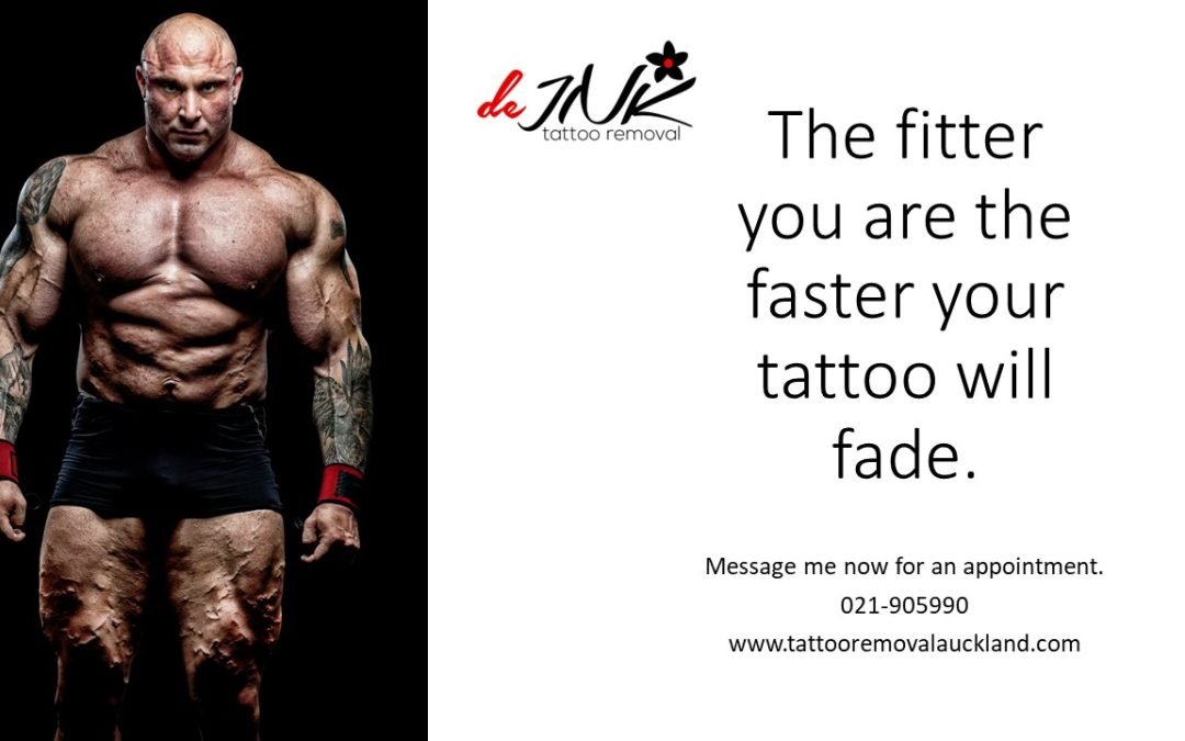 Tattoo Removal Creams Don't Work - Fade Away Laser