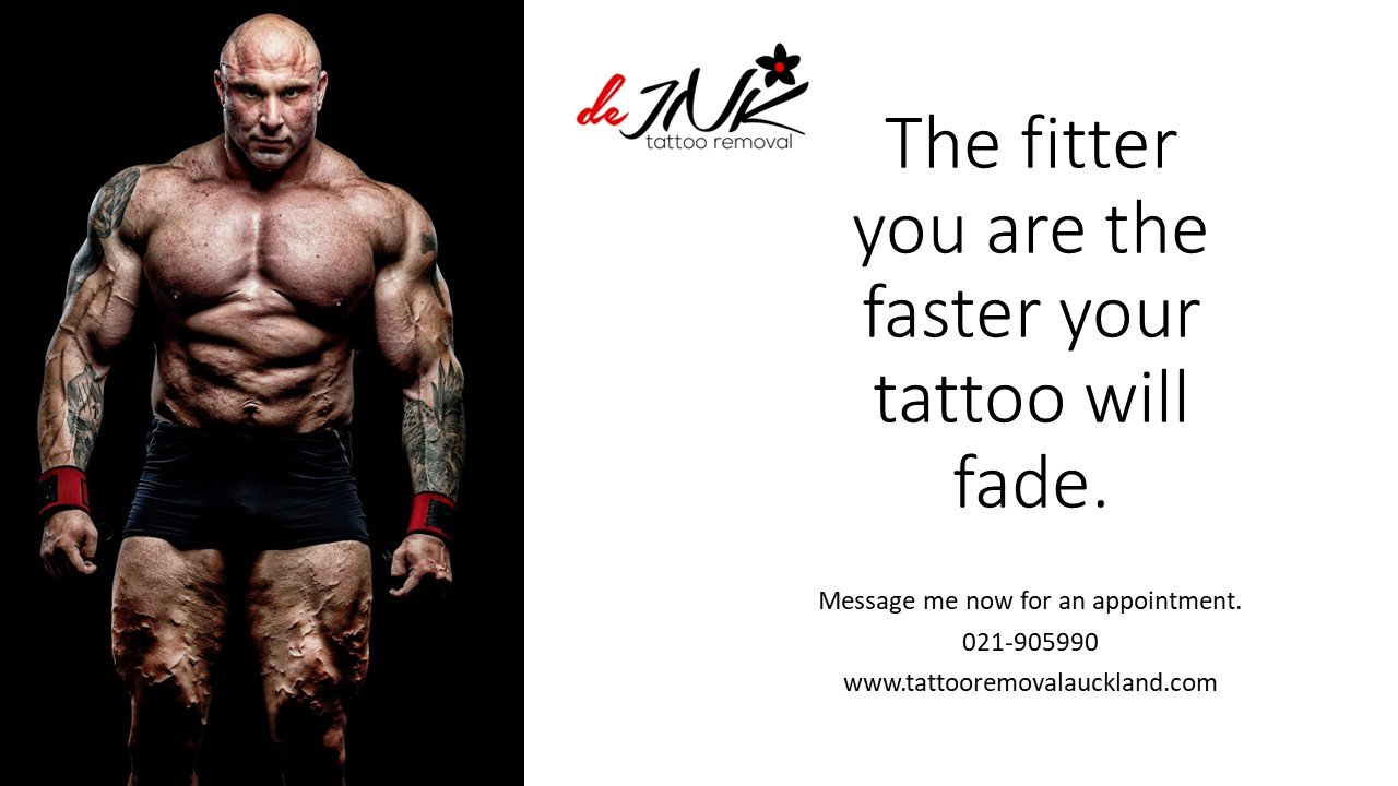Is it true that tattoo laser removal leaves a scar  Quora